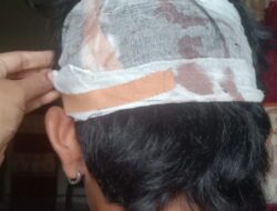 Pelaku Pengeroyokan Masih Bebas Berkeliaran, Keluarga Korban di Burau Kecewa: Laporan Polisi Mandek