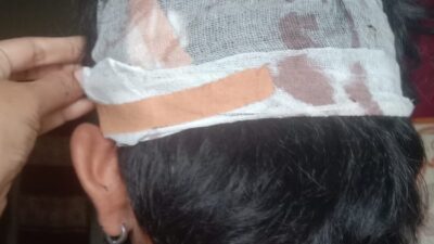 Pelaku Pengeroyokan Masih Bebas Berkeliaran, Keluarga Korban di Burau Kecewa: Laporan Polisi Mandek